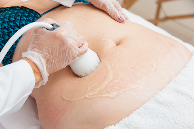 Shape 360 Fase 1 - Tratamento de redução de medidas Lumevié